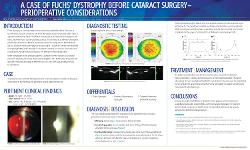 A case of Fuchs' Dystrophy before cataract surgery - perioperative considerations